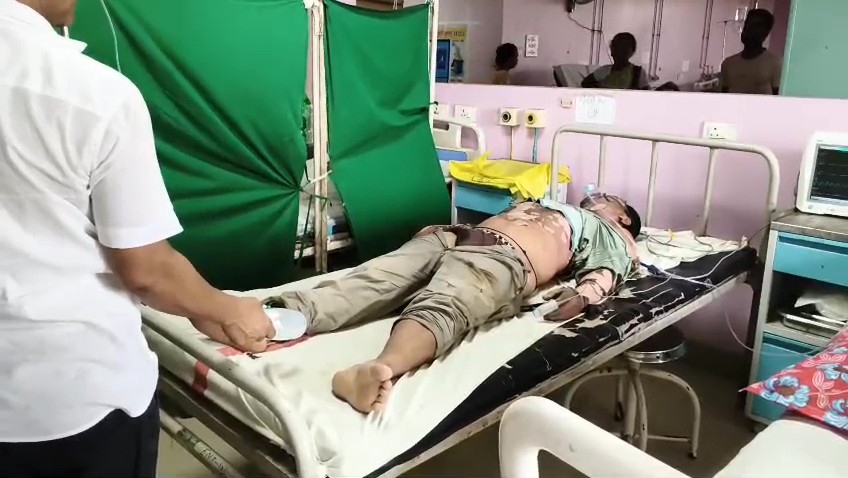   সহকর্মীদের গাফিলতিতে বিদ্যুৎস্পৃষ্ট বিদ্যুৎ নিগম কর্মী, জিবিতে চিকিৎসাধীন